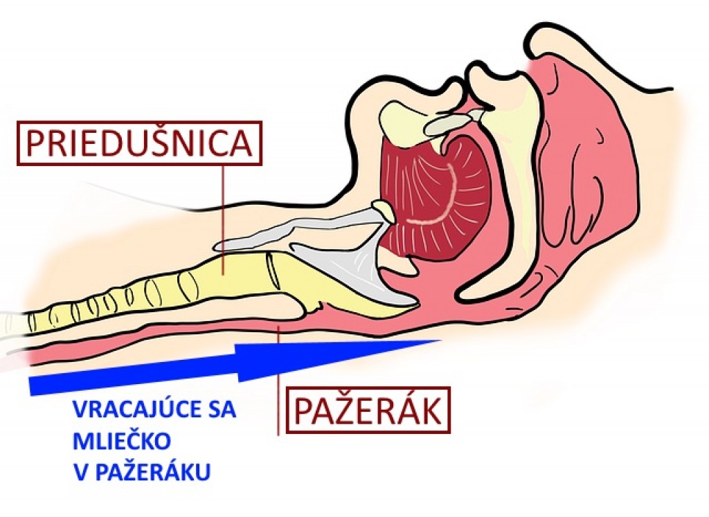 Odgrgnutie a reflux.